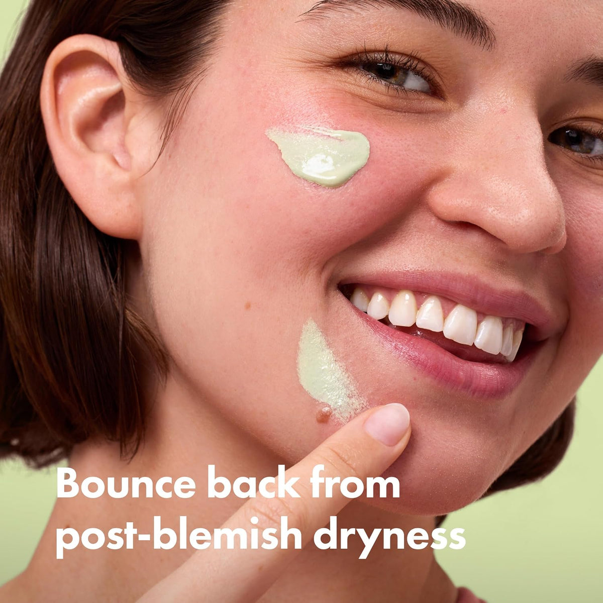 HERO COSMETICS Rescue Balm +Red Correct- New Formula-The Color-Correcting Green Cream. New Matte Formula Improves the Look of Post-Blemish Redness and Marks plus Hydrates Skin